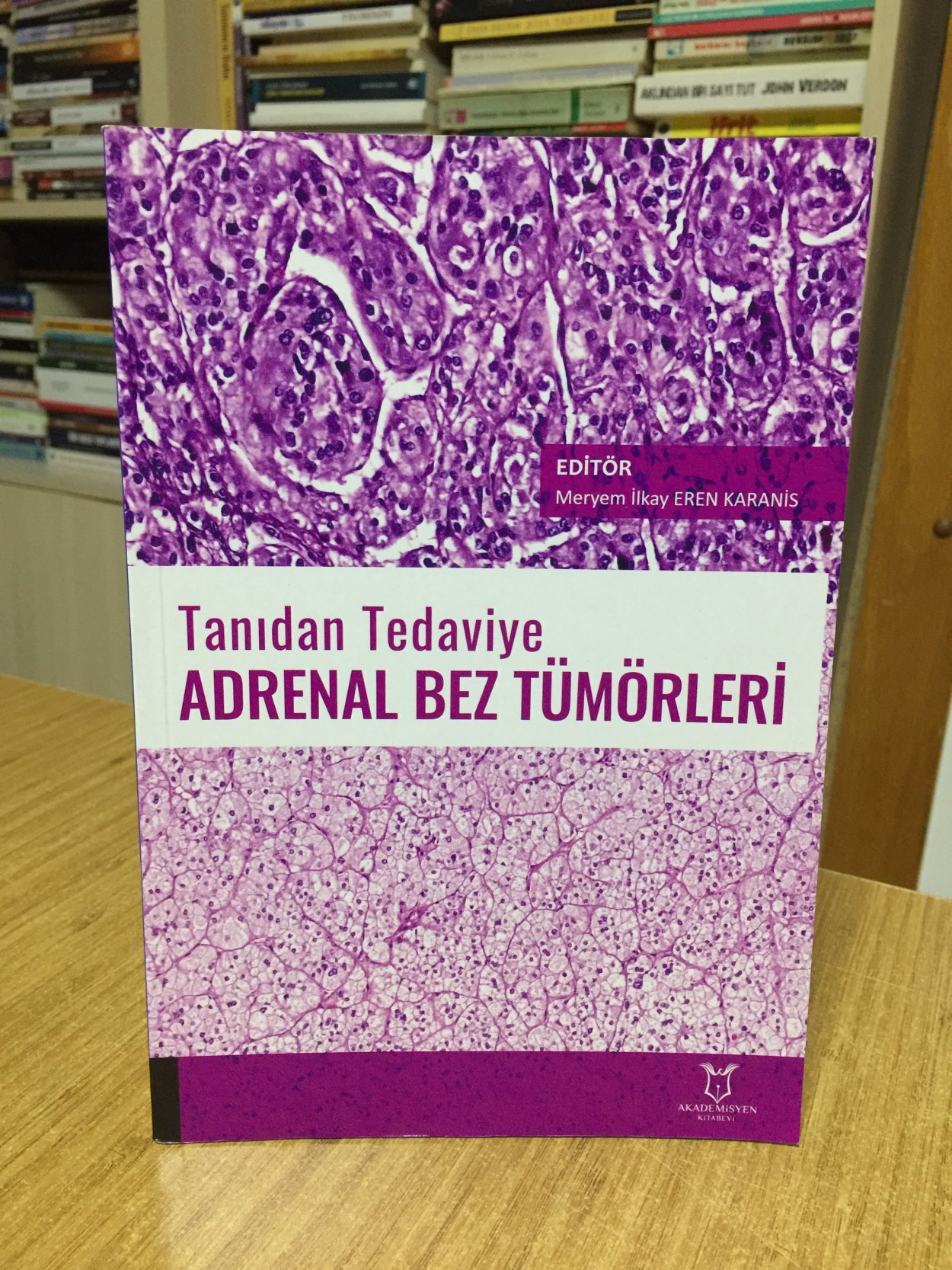 Tanıdan Tedaviye Adrenal Bez Tümörleri - Editör: Meryem İlkay Eren Karanis